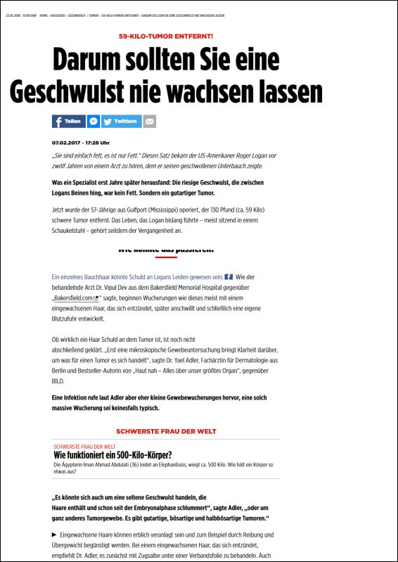 Darum sollten Sie eine Geschwulst nie wachsen lassen
