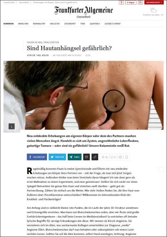 Sind Hautanhängsel gefährlich?