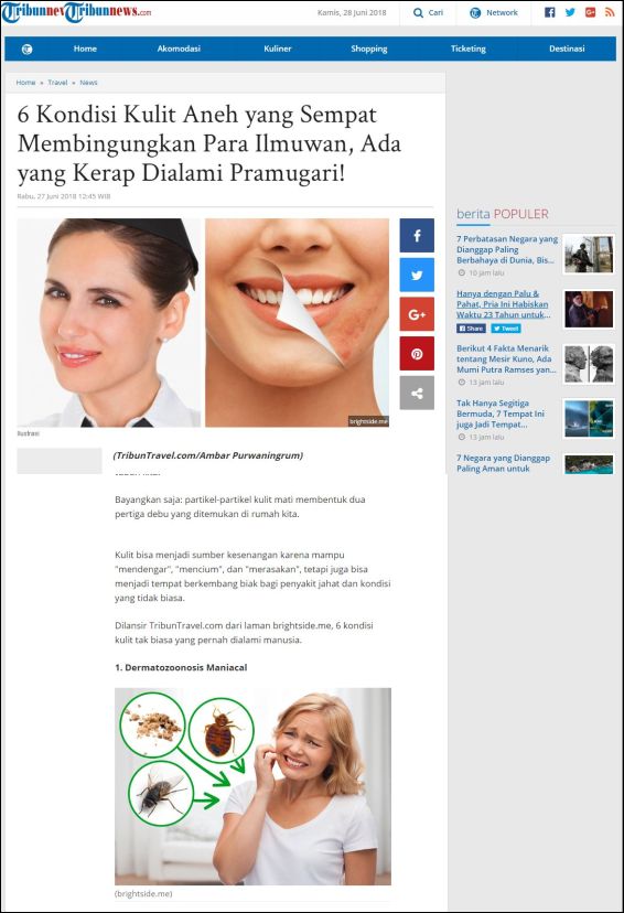6 Kondisi Kulit Aneh yang Sempat Membingungkan Para Ilmuwan, Ada yang Kerap Dialami Pramugari!