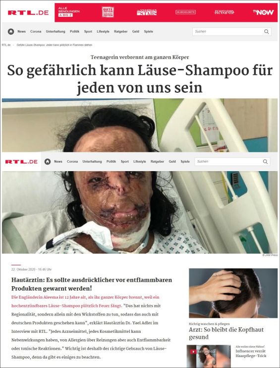 So gefährlich kann Läuse-Shampoo für jeden von uns sein