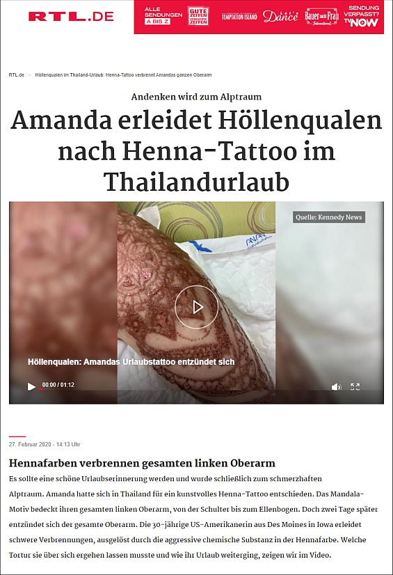 Hennafarben verbrennen gesamten linken Oberarm