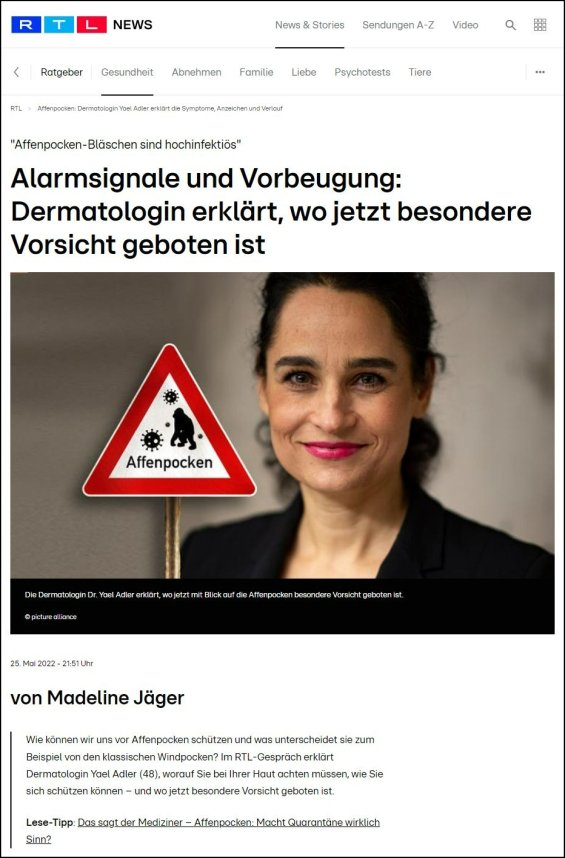 Affenpocken-Bläschen sind hochinfektiös | Alarmsignale und Vorbeugung